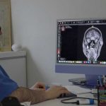 “Nga epilepsia deri tek…” Një në tre shqiptarë me probleme neurologjike të ndryshme