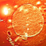 E kanë përdorur edhe klinika fertiliteti në Shqipëri, dhuruesi me gjen kancerogjen është babai i rreth 200 fëmijëve në Europë