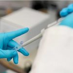 Studimi: 40% e rasteve të reja të kancerit në botë mund të parandalohen