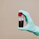 Analiza e gjakut që ndihmon në parashikimin se kush ka më shumë gjasa të jetojë më gjatë