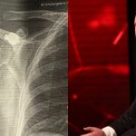 I mbijetuari i luftës zbulon pas 27 vitesh plumbin në trup: Metali që mposhta për të shijuar lirinë e Kosovës