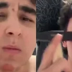 Godasin fytyrën me çekiçë për mollëza më të theksuara, trendi ekstrem që ka lënë mbi 100 të rinj të lënduar në Rusi