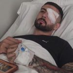 “Më goditi plumbi i gomës në sy, bëra dy hapa dhe rashë në tokë”, Erjon Vishkulli tregon nga shtrati i spitalit: Kam shumë dhimbje, Shqipëria është e jona!