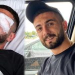 Lajm i mirë nga Roma, Erjon Vishkulli kalon me sukses operacionin, ndërhyrja i shpëton syrin