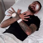 U plagos në sy gjatë protestës, Erjon Vishkulli reagon pas operacionit në Itali: Zoti do të krijojë lehtësim pas vështirësive!